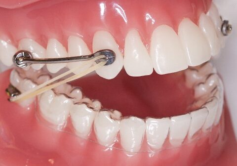 Rogers Orthodontics
